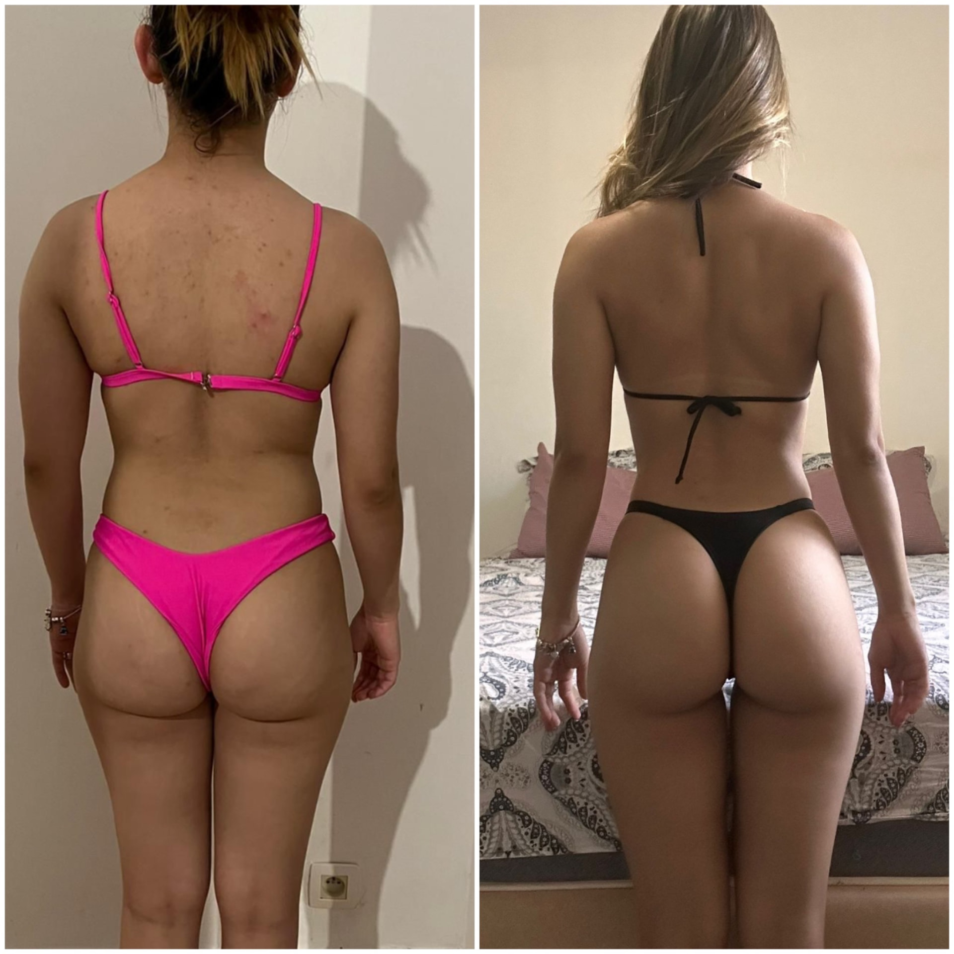 Antes e depois ilustrativo de Amanda S.
